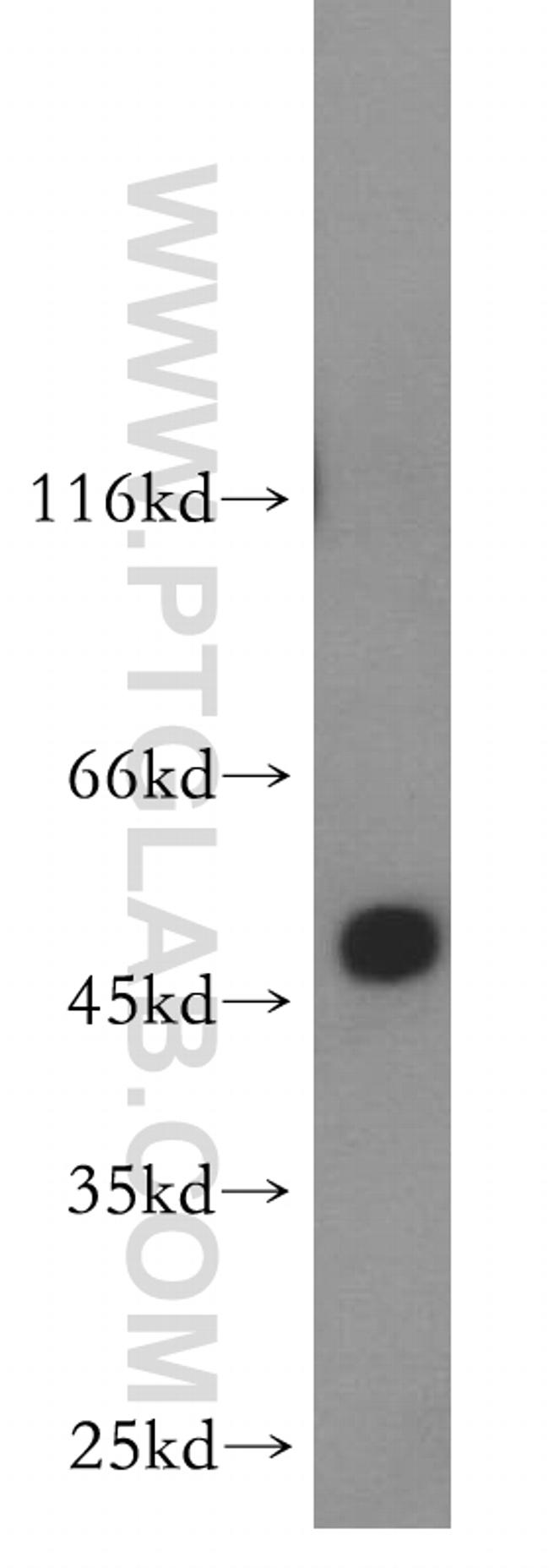 ABHD2 Antibody in Western Blot (WB)