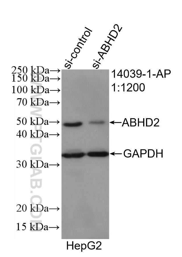 ABHD2 Antibody in Western Blot (WB)