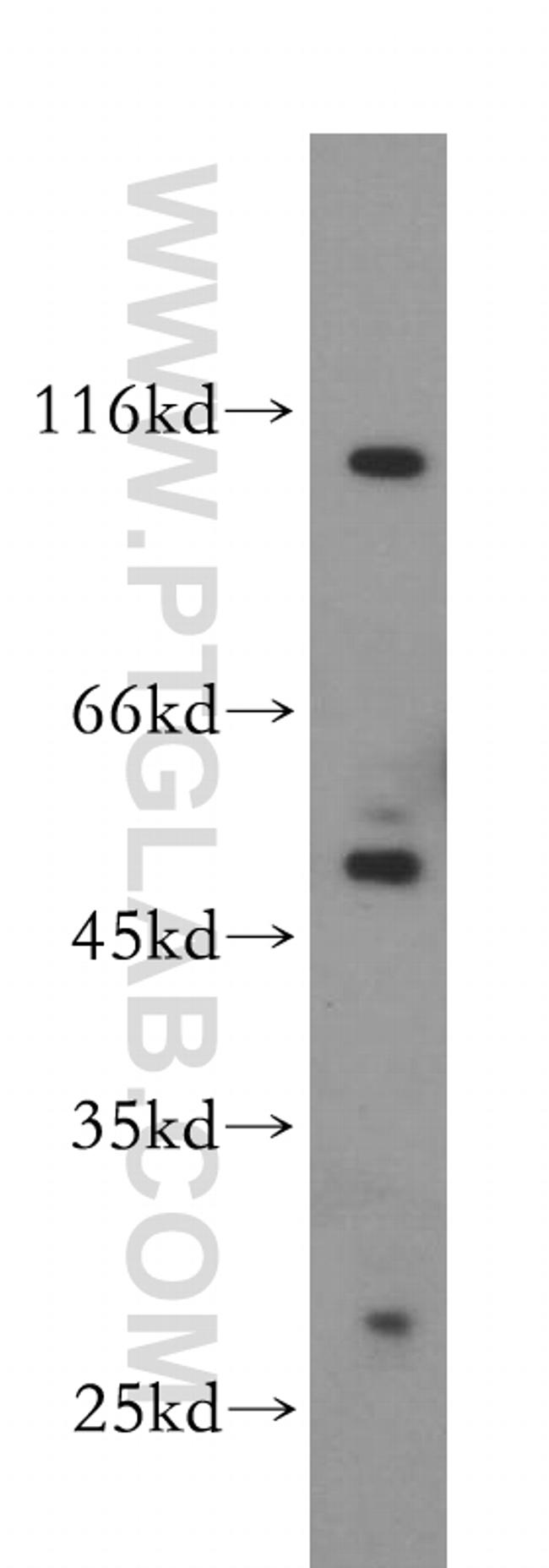 ABHD2 Antibody in Western Blot (WB)