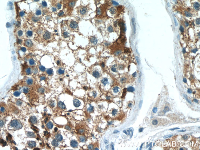 ACRV1 Antibody in Immunohistochemistry (Paraffin) (IHC (P))