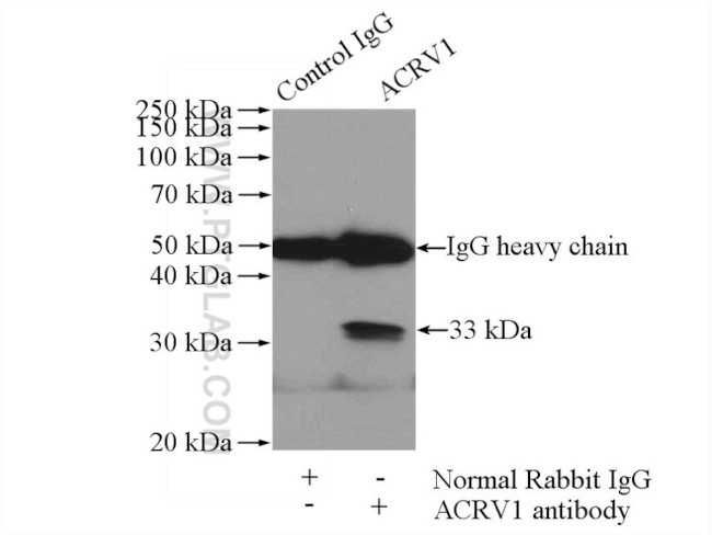 ACRV1 Antibody in Immunoprecipitation (IP)