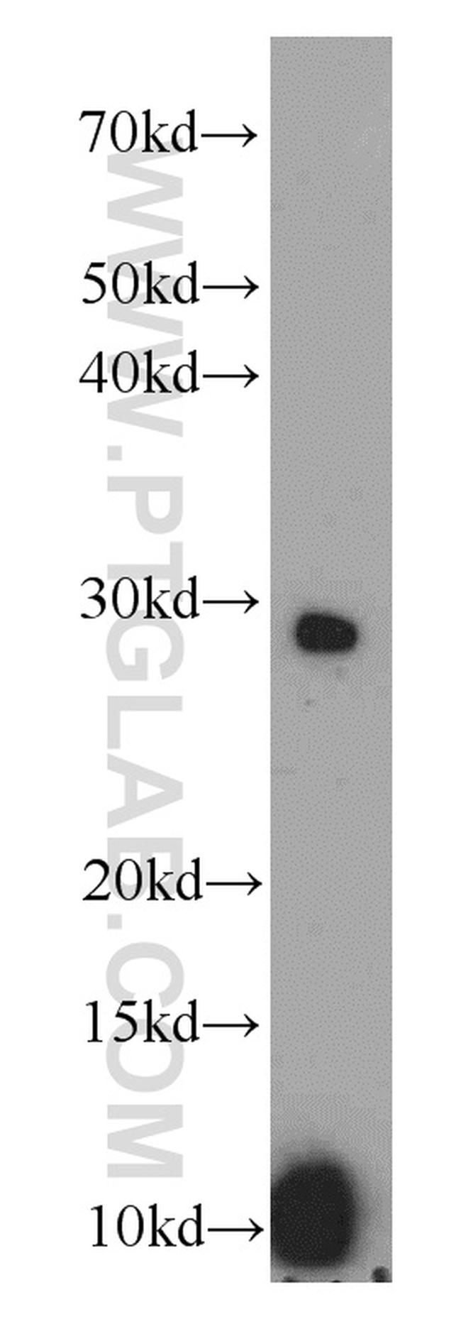 ACRV1 Antibody in Western Blot (WB)