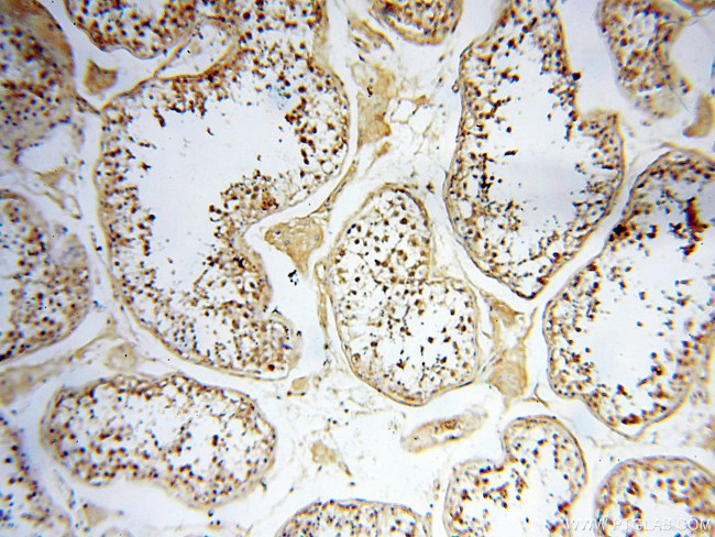 DDX3Y Antibody in Immunohistochemistry (Paraffin) (IHC (P))