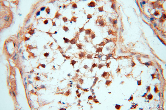 DDX3Y Antibody in Immunohistochemistry (Paraffin) (IHC (P))