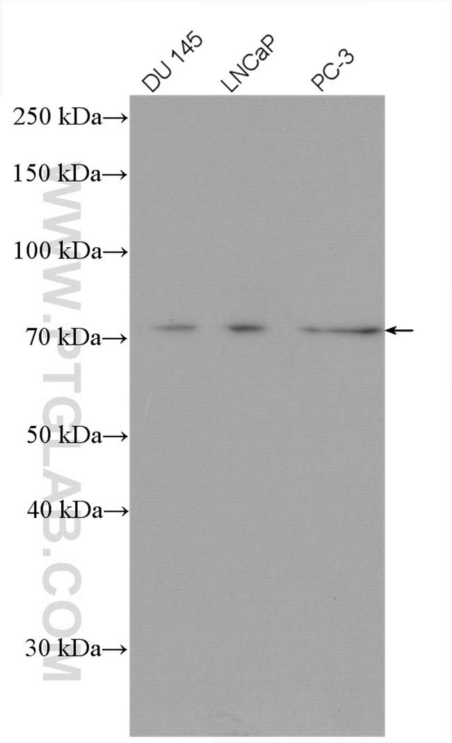 DDX3Y Antibody in Western Blot (WB)