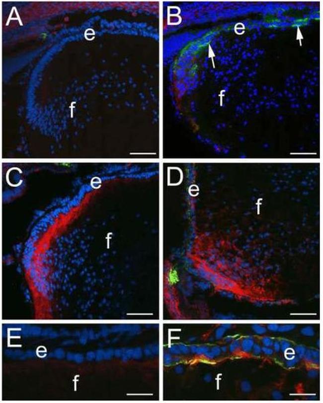 CD44 Antibody in Immunohistochemistry (IHC)