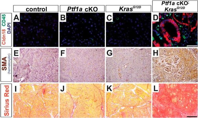 CD45 Antibody in Immunohistochemistry (Paraffin) (IHC (P))