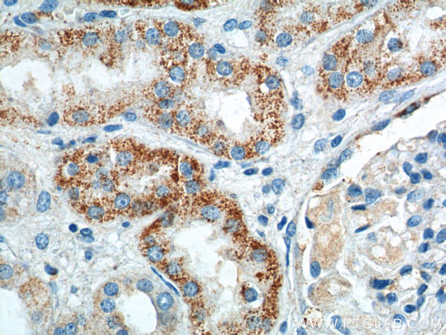 GPR116 Antibody in Immunohistochemistry (Paraffin) (IHC (P))