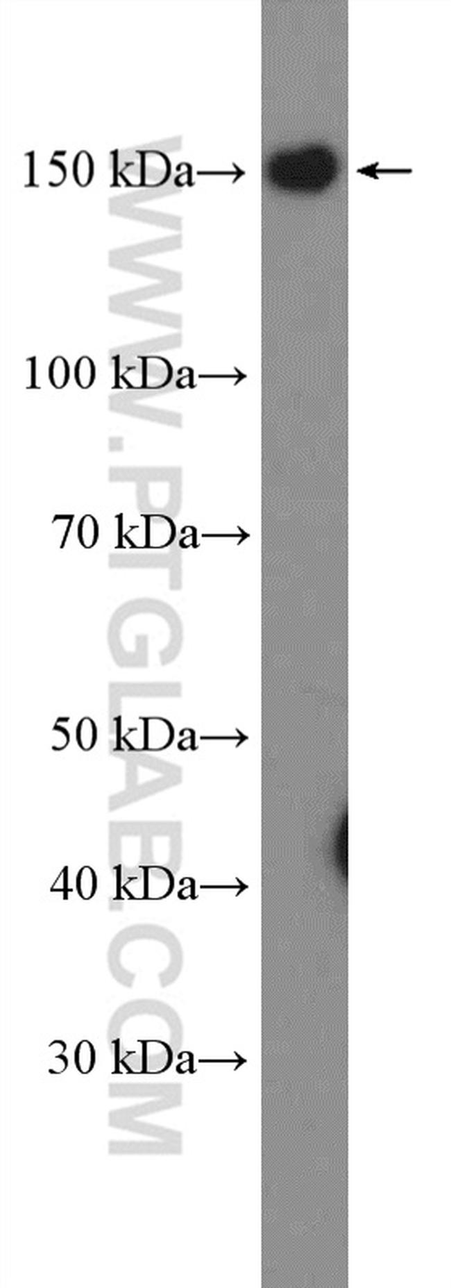 GPR116 Antibody in Western Blot (WB)