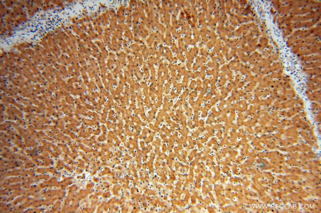 SLC27A2 Antibody in Immunohistochemistry (Paraffin) (IHC (P))