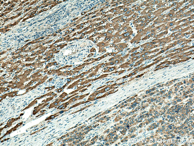 SLC27A2 Antibody in Immunohistochemistry (Paraffin) (IHC (P))