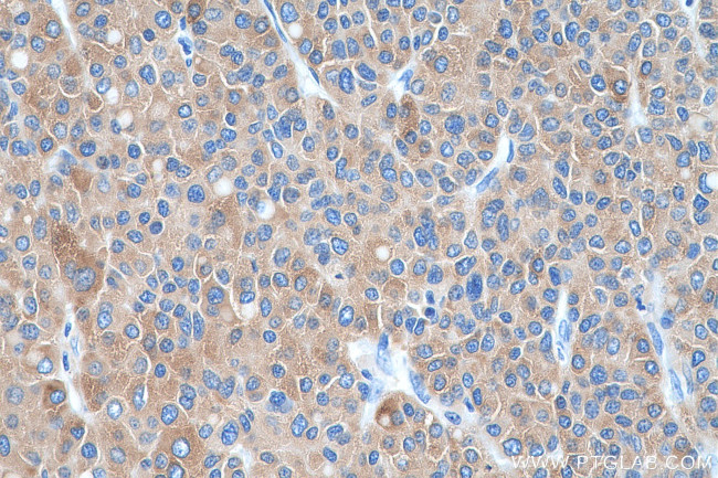 SLC27A2 Antibody in Immunohistochemistry (Paraffin) (IHC (P))