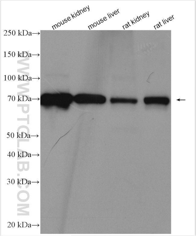 SLC27A2 Antibody in Western Blot (WB)
