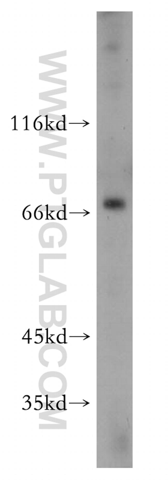 SLC27A2 Antibody in Western Blot (WB)