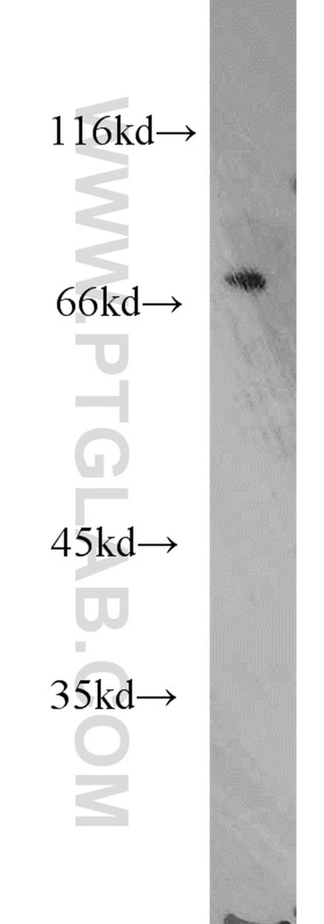 SLC27A2 Antibody in Western Blot (WB)