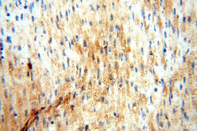 MAN1A2 Antibody in Immunohistochemistry (Paraffin) (IHC (P))