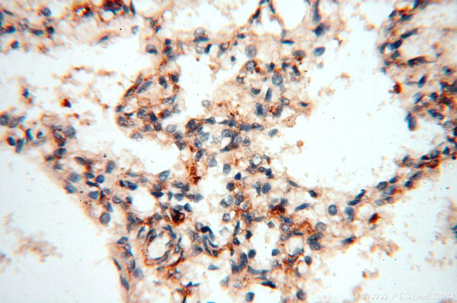 MAN1A2 Antibody in Immunohistochemistry (Paraffin) (IHC (P))