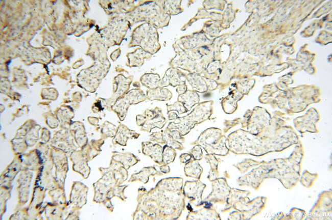 MAN1A2 Antibody in Immunohistochemistry (Paraffin) (IHC (P))