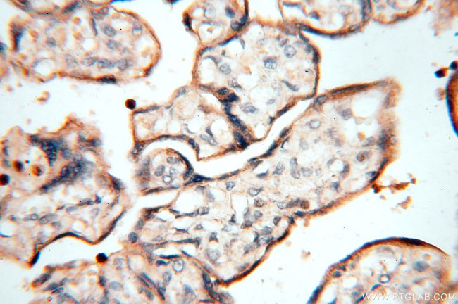 MAN1A2 Antibody in Immunohistochemistry (Paraffin) (IHC (P))