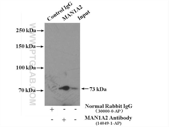 MAN1A2 Antibody in Immunoprecipitation (IP)
