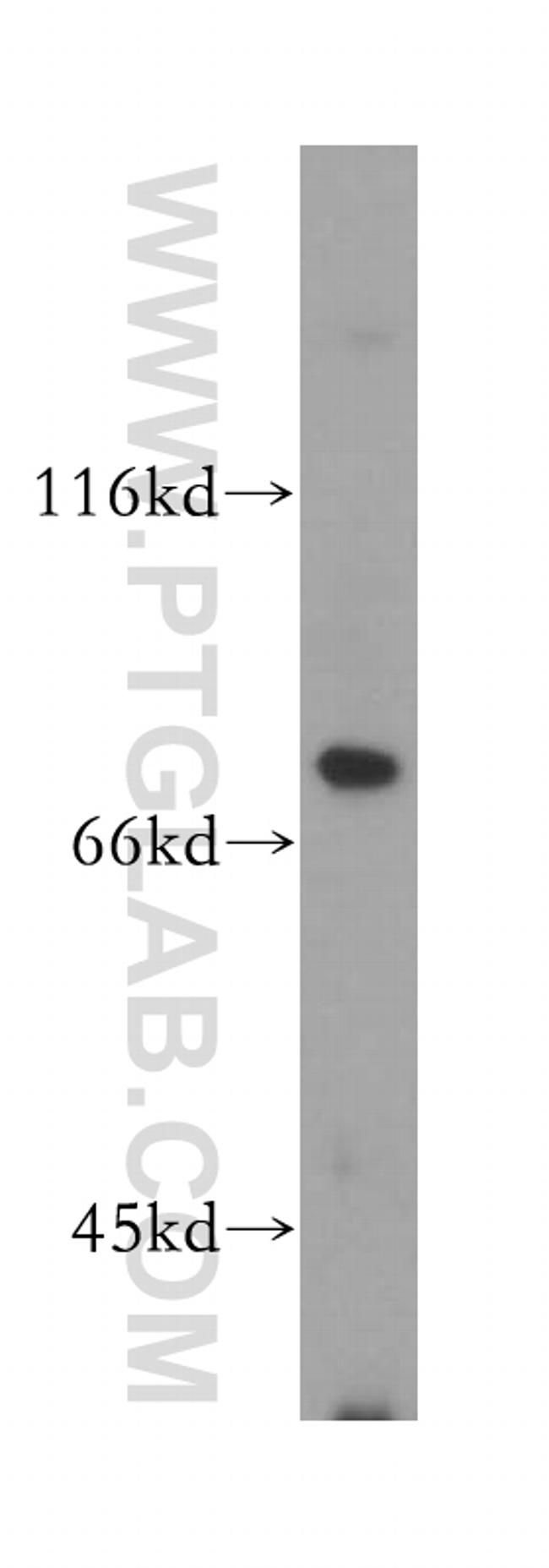 MAN1A2 Antibody in Western Blot (WB)