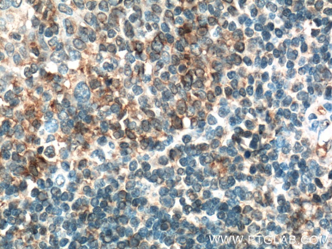 CD200 Antibody in Immunohistochemistry (Paraffin) (IHC (P))