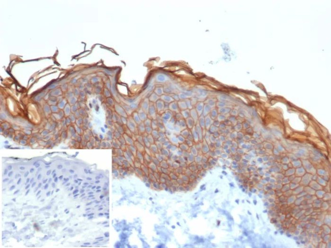 S100A16 (S100 calcium binding protein A16) Antibody in Immunohistochemistry (Paraffin) (IHC (P))