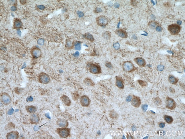 PARK2/Parkin Antibody in Immunohistochemistry (Paraffin) (IHC (P))