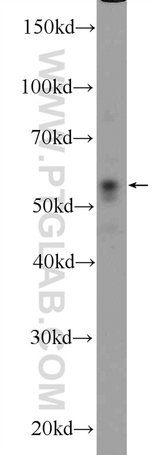 PARK2/Parkin Antibody in Western Blot (WB)