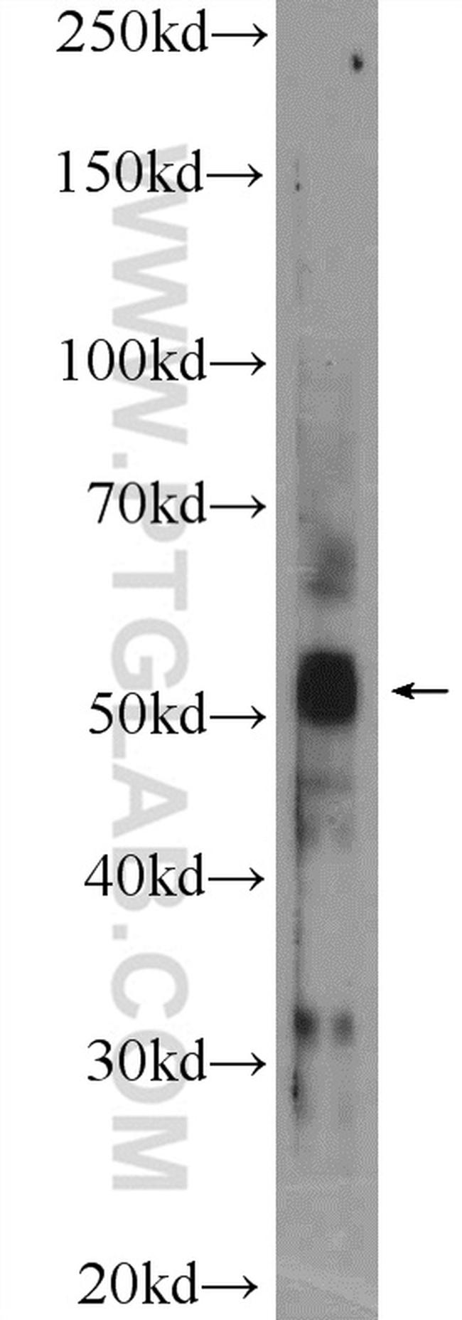 PARK2/Parkin Antibody in Western Blot (WB)