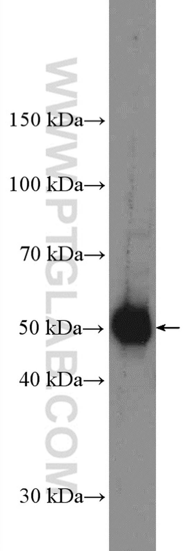 PARK2/Parkin Antibody in Western Blot (WB)