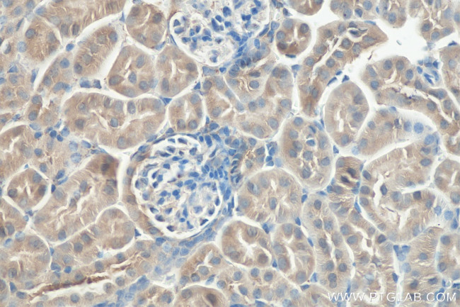 PARK2/Parkin Antibody in Immunohistochemistry (Paraffin) (IHC (P))