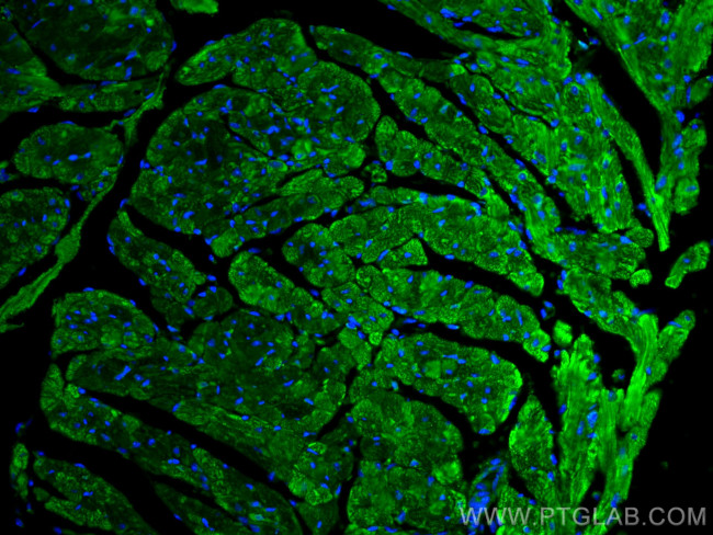 PARK2/Parkin Antibody in Immunohistochemistry (PFA fixed) (IHC (PFA))