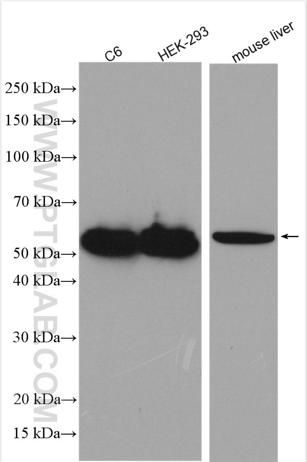 PARK2/Parkin Antibody in Western Blot (WB)