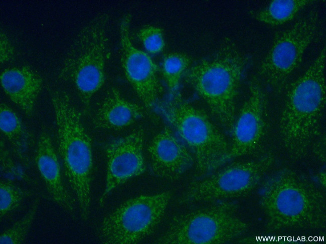 PARK2/Parkin Antibody in Immunocytochemistry (ICC/IF)