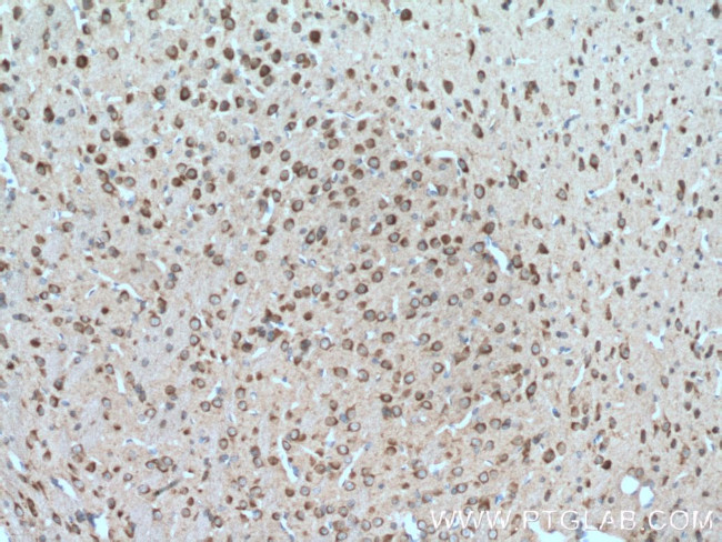 PARK2/Parkin Antibody in Immunohistochemistry (Paraffin) (IHC (P))