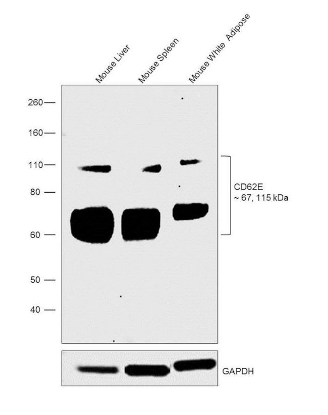 CD62E (E-selectin) Antibody