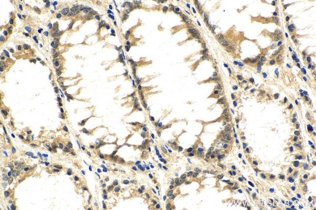 p38 MAPK Antibody in Immunohistochemistry (Paraffin) (IHC (P))