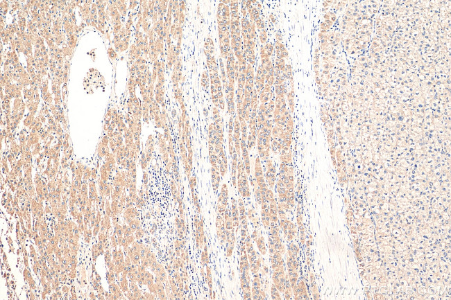 p38 MAPK Antibody in Immunohistochemistry (Paraffin) (IHC (P))