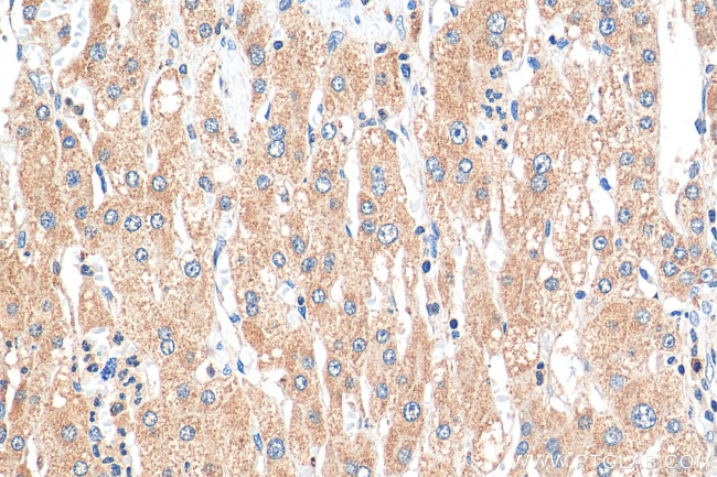 p38 MAPK Antibody in Immunohistochemistry (Paraffin) (IHC (P))