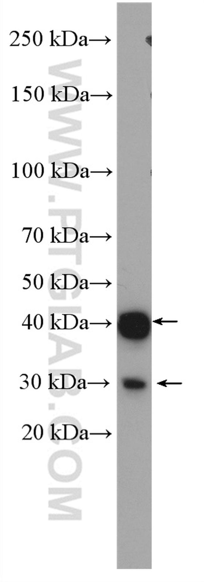 p38 MAPK Antibody in Western Blot (WB)