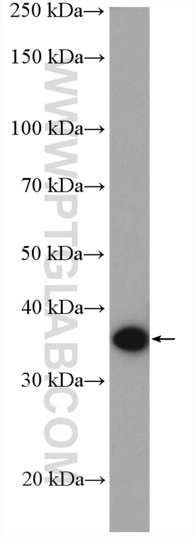 p38 MAPK Antibody in Western Blot (WB)