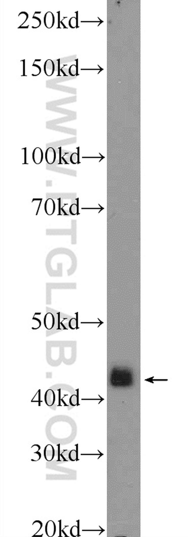 p38 MAPK Antibody in Western Blot (WB)