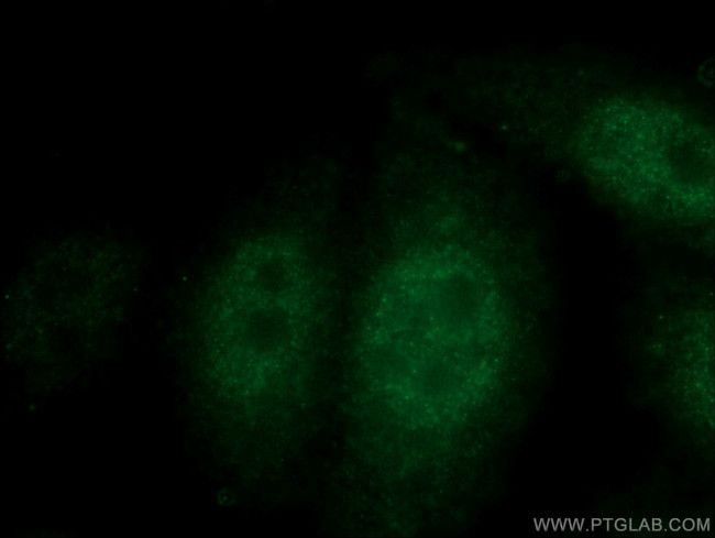 p38 MAPK Antibody in Immunocytochemistry (ICC/IF)