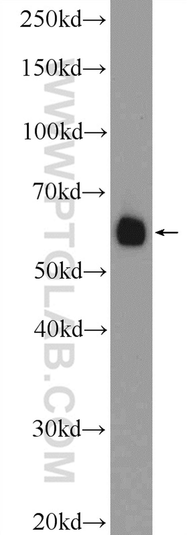 DAZ4 Antibody in Western Blot (WB)