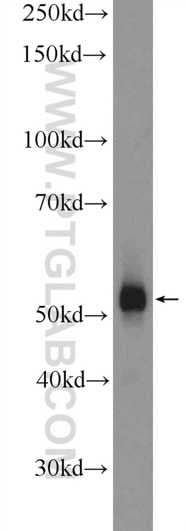 DAZ4 Antibody in Western Blot (WB)