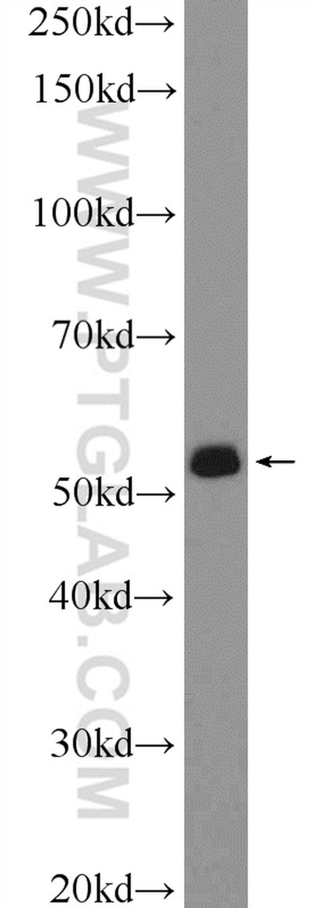 DAZ4 Antibody in Western Blot (WB)