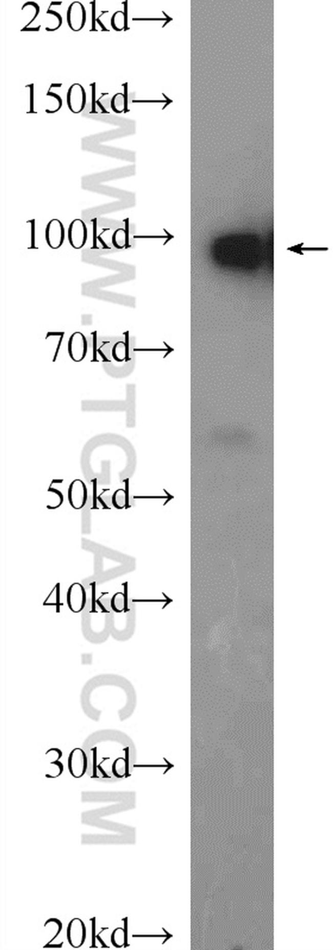 CNNM4 Antibody in Western Blot (WB)