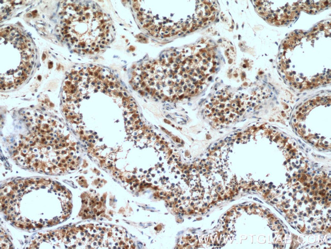 CCP1 Antibody in Immunohistochemistry (Paraffin) (IHC (P))