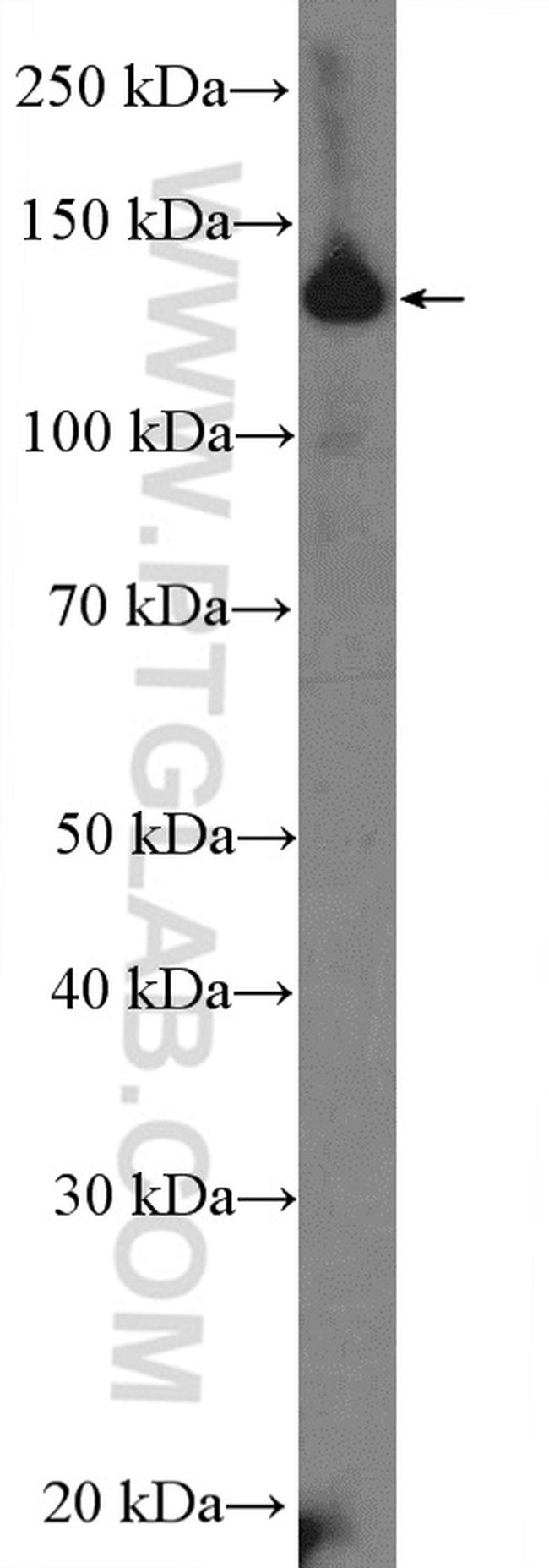 CCP1 Antibody in Western Blot (WB)